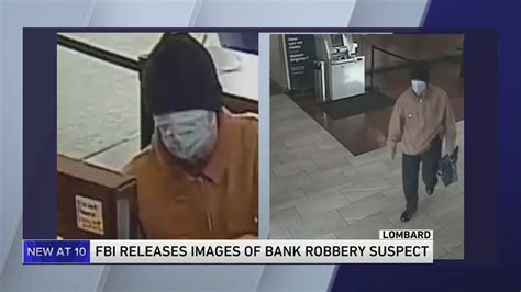 FBI searching for Lombard bank robbery suspect with possible skin disorder