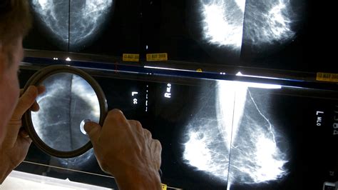 FDA updates mammogram regulations to help detect breast cancer sooner
