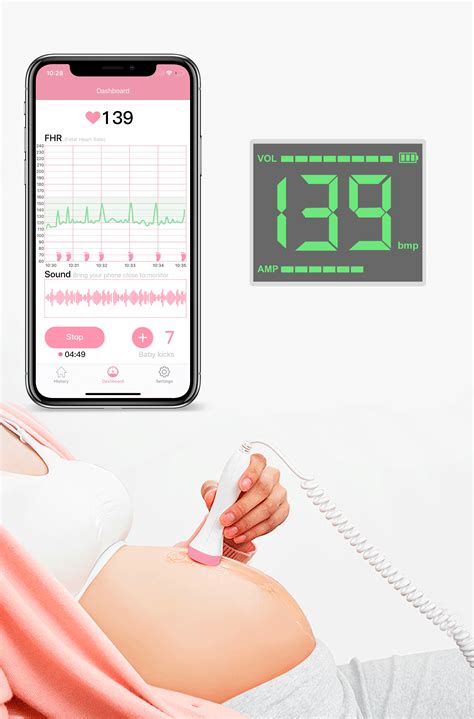 Fetal Heart Monitors - What to Expect - coolestguyplanet.net