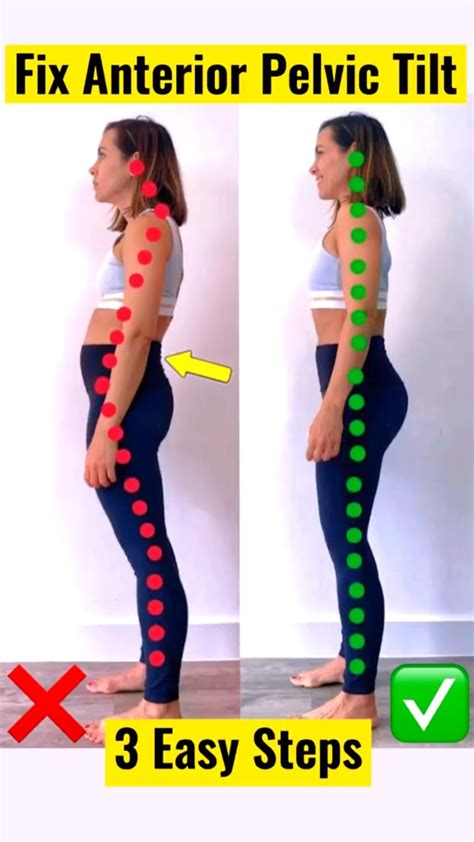 Fix Anterior Pelvic Tilt in 10 Minutes a Day! Posture ... - balustradellc