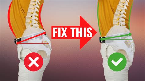 FIX Anterior Pelvic Tilt in 100 Seconds for PERFECT Posture - balustradellc