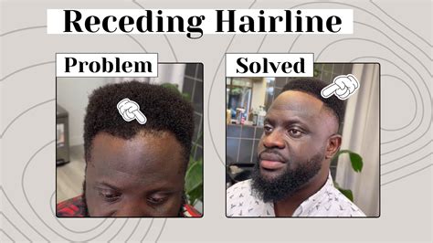 Fix edges, receding hairline, patchy beard or anything BEARD / HAIR ... - balustradellc