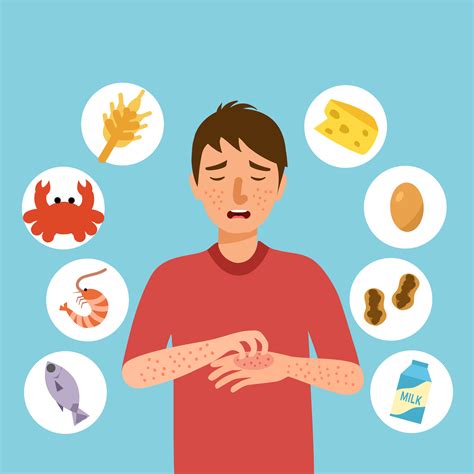 Food Allergies | Causes, Symptoms & Treatment - balustradellc