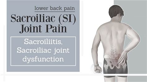 For those struggling to heal from SI Joint Pain/Sacroiliitis - I'll ... - balustradellc
