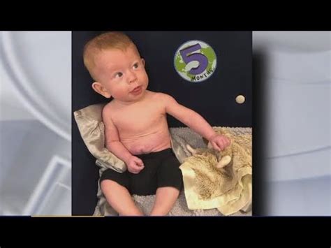 FOX 2 catches up with baby born with organs on outside