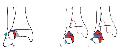 FRAKTUR - Calligraphy Collective - muktibox.com