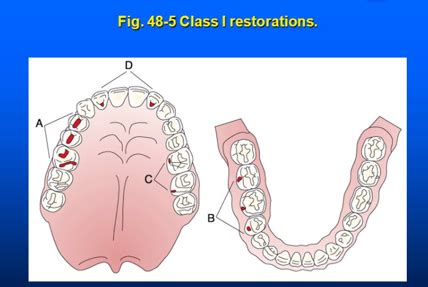 Free Dentistry Flashcards and Study Games about General Dentistry - balustradellc