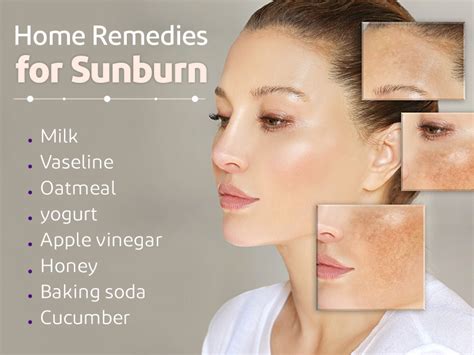 From antioxidants to cold compresses: How to treat a sunburnt face ... - balustradellc