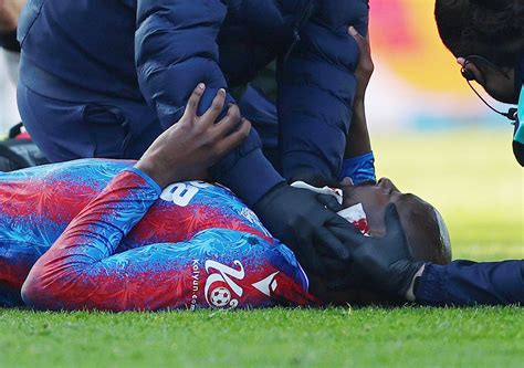 From Colombia: Encouraging Crystal Palace injury update - balustradellc