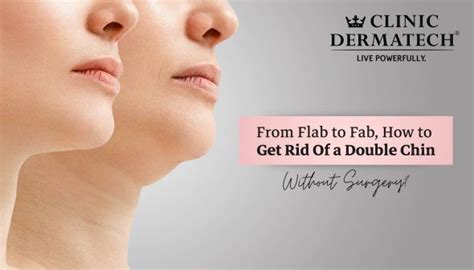 From Flab to Fab, How to Get Rid of a Double Chin … - balustradellc