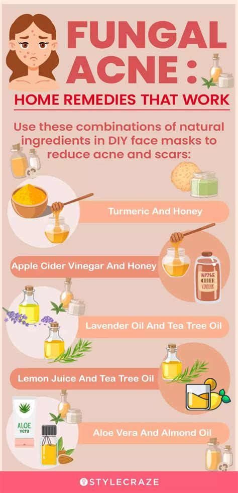 Fungal Acne Treatment at Home: Managing … - balustradellc