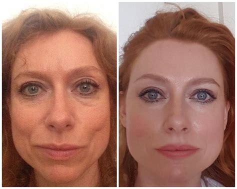 Face yoga before and after. Face Yoga with Koko, face training lessons to decrease signs of aging, was started by Koko Hayashi in 2018. As of August 2023, Face Yoga with Koko’s net worth is $2 Million, and the business is still operational, suggesting that it has sustained its sales and is continuing to grow. In 2019, they appeared on Season 11 Episode 2 of Shark Tank USA, … 