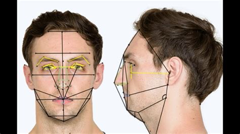 Facial analysis. According to the facial analysis results, the trichion–gnathion/right zygoma–left zygoma was assessed: 33.1% of the patients were in normal facial morphology, 36.8% were in long facial morphology and 30.1% were in short facial morphology, according to this proportion. The trichion–gnathion/right zygoma–left … 