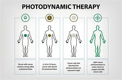 Fact Sheet for Documenting the Need for Photodynamic Therapy (PDT)