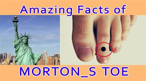 Facts about Morton