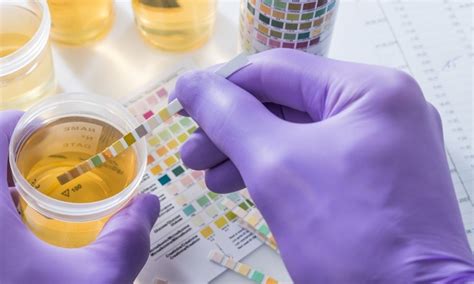 Failing a Probation Drug Test Consequences and Next Steps