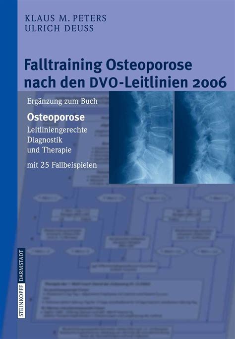 Falltraining osteoporose nach den dvo leitlinien 2006. - Environmental science speedy study guide by speedy publishing.