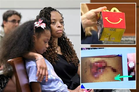 Family says a hot chicken nugget scalded girl’s leg. Now they are suing McDonald’s over Happy Meal