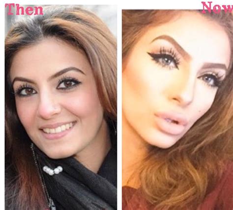 Faryal Makhdoom Nose Job - Faryal Makhdoom …