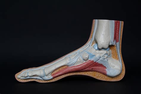 Fascite plantar: veja causas, sintomas e tratamento