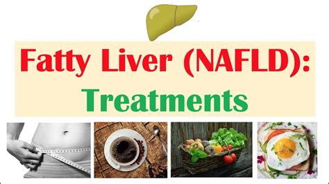 Full Download Fatty Liver Diet Treat Reverse And Cure Fatty Liver Disease One Bite At A Time By Dr Junaid Tariq