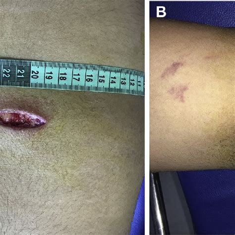 Federal prisons in california.  The officer sustained multiple puncture wounds.  section ...