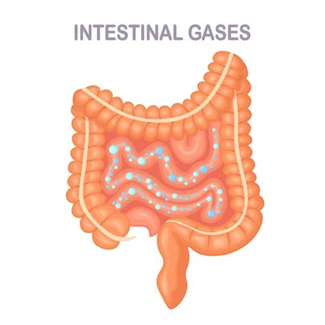 Diarrhea is a symptom that has many causes. It is mainly due to increased water content within the bowels and/or hyperactivity of the bowels. Bubbling in the bowels is a common symptom that precedes diarrhea and continues thereafter until the diarrhea resolves. Irritable bowel syndrome (IBS) is a condition marked by abnormal bowel habit …. 