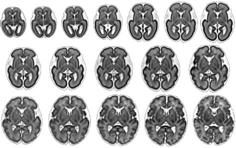 Fetal Brain Atlas - University of Southern California