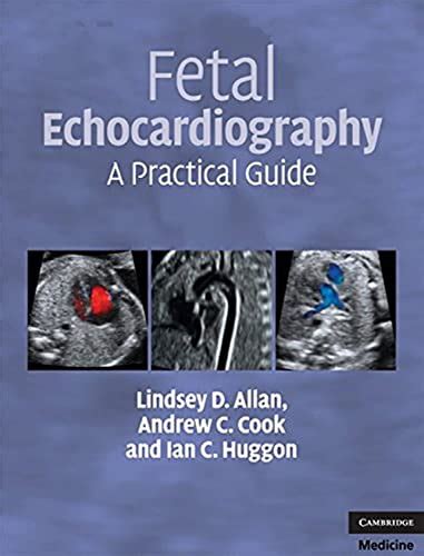 Fetal echocardiography a practical guide allan fetal echocardiography. - Briggs and stratton manuale del motore da 195 cv.