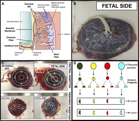 Fetal-Placental Tissue for Cytogenetics Collection