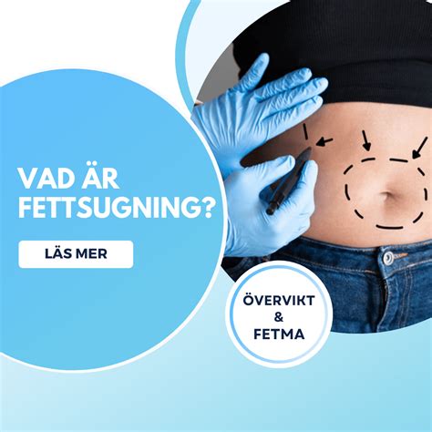 Fettsugning umeå