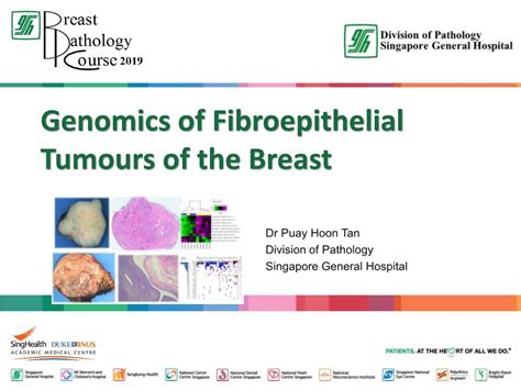 Fibroepithelial tumours of the breast—a review SpringerLink