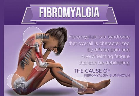 Fibromyalgia, chronic fatigue and muscle pain produced by DAO ...