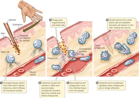 Figure 39. Picture