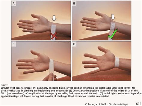 Finger tape climbing.  Taping can help reduce strain on delicate finger j...