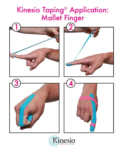 Finger tape for jammed finger.  Learn about the "lattice technique", ...