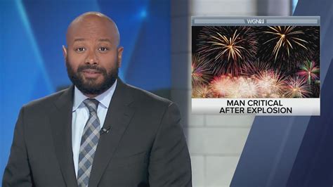 Firework explodes on suburban man's face; critical condition