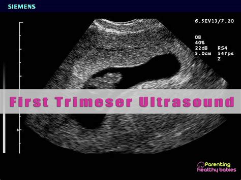 First ultrasound in first trimester