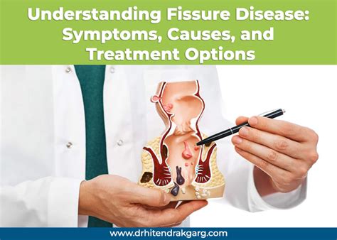 Fissure problem.  In some cases, it can be deep enough to expose the underlying...