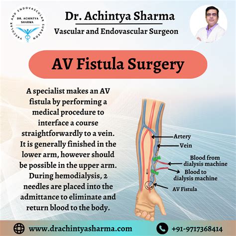 Fistula surgery anesthesia.  Surgery for fistula-in-ano should not .  ...