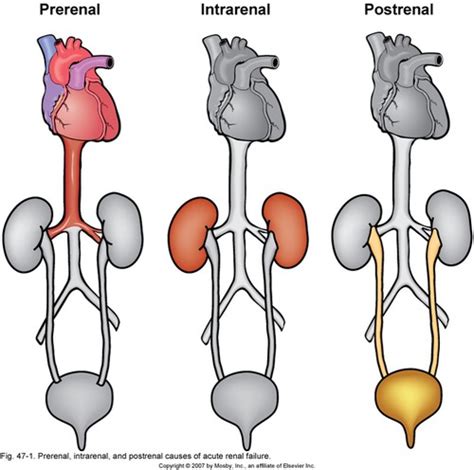 Flashcards - Adult Health - Renal & Urinary - FreezingBlue