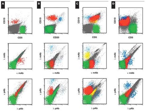 Flow Cytometric Analysis of Surface Light Chain ... - Oxford …