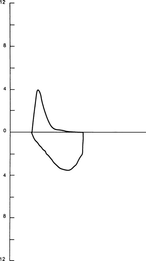 Flow Volume Loops in Diagnosis - CHEST