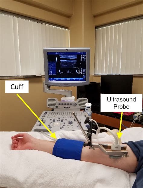 FlowMediated Dilation for Assessment of Endothelial Function Human