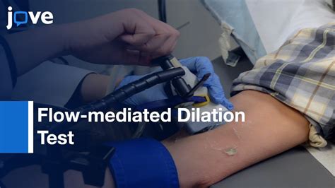 Flowmediated Dilation Test By U/S of Endothelial Function Protocol