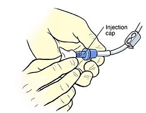 Flushing Your PICC Line at Home