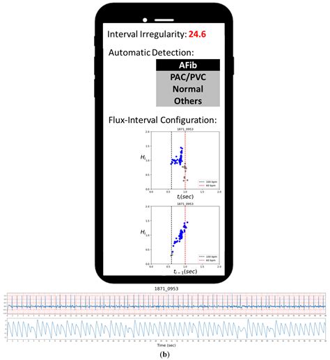 Flux interval example.  Is there any possibility to do these queries on a spec...