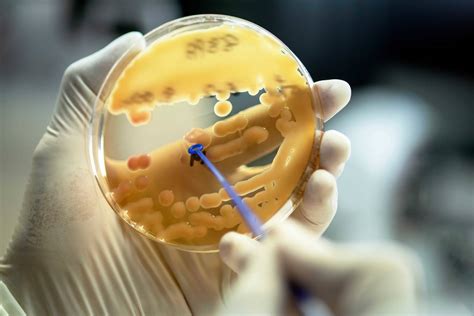 Foodborne Pathogen Detection Invitek Diagnostics