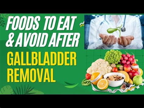 Foods to avoid once gallbladder is removed