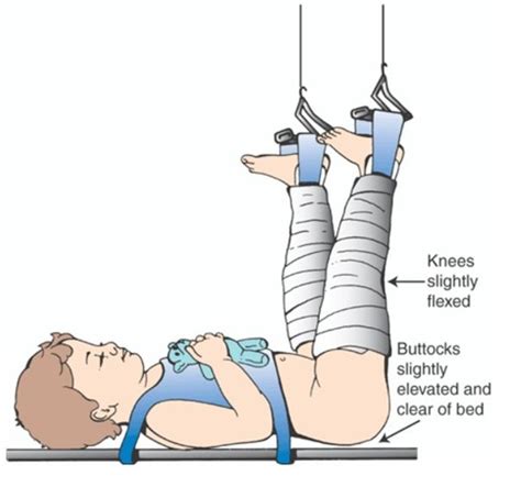 Foot Care Course Definitions Flashcards Quizlet